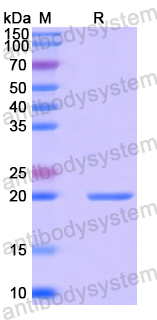 Recombinant Human TGIF2 Protein, N-His-SUMO