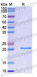 Recombinant Human TRAIP Protein, N-His-SUMO
