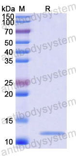 Recombinant Human TRPC4AP Protein, N-His