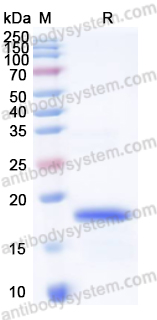 Recombinant Human PAF1 Protein, N-His