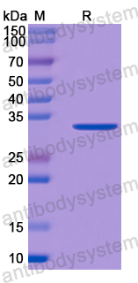 Recombinant Human HSDL2 Protein, N-His