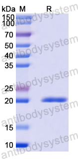 Recombinant Human HSPB8 Protein, N-His-SUMO
