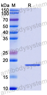 Recombinant Human LHX4 Protein, N-His