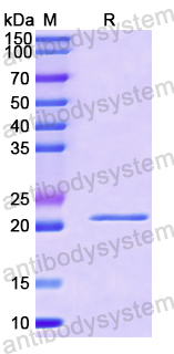 Recombinant Human MAD1L1 Protein, N-His
