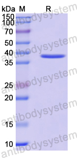 Recombinant Human MECR Protein, N-His