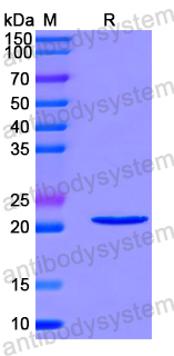 Recombinant Human MED30 Protein, N-His-SUMO