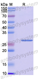 Recombinant Human RIOX2 Protein, N-His