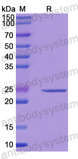 Recombinant Human MOB1B Protein, N-His