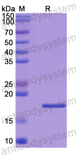 Recombinant Human PDRG1 Protein, N-His