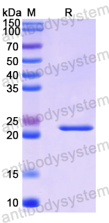 Recombinant Human SLCO2A1 Protein, N-His-SUMO