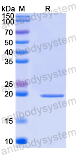 Recombinant Human PMFBP1 Protein, N-His