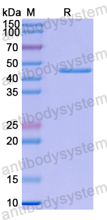 Recombinant Human BABAM2 Protein, N-His
