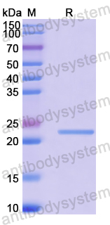 Recombinant Human CDCA4 Protein, N-His-SUMO