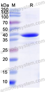 Recombinant Human CDK12 Protein, N-His