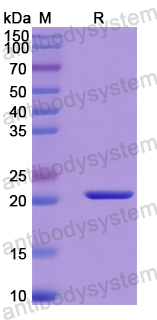 Recombinant Human HOXC10 Protein, N-His-SUMO