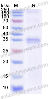 Recombinant Human KIAA0319L Protein, N-His