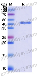 Recombinant Human KIF2C Protein, N-His