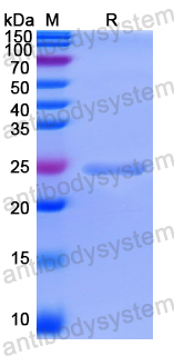 Recombinant Human GINS2 Protein, N-His