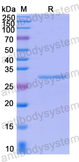 Recombinant Human MAGED2 Protein, N-His