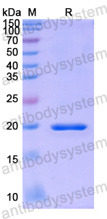 Recombinant Human ASF1A Protein, N-His