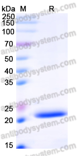 Recombinant Human EIF4E3 Protein, N-His