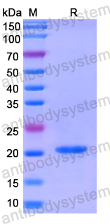 Recombinant Human TMOD4 Protein, N-His
