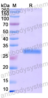 Recombinant Human BCCIP Protein, N-His