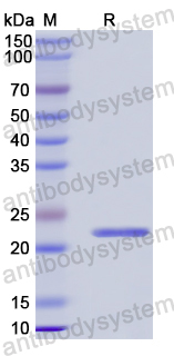 Recombinant Human TIMM9 Protein, N-His-SUMO