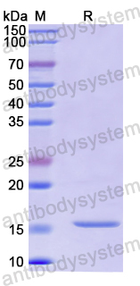 Recombinant Human KCTD12 Protein, N-His