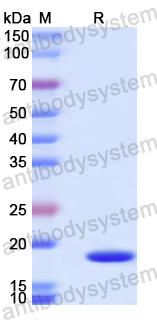 Recombinant Human BHLHE41 Protein, N-His