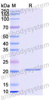 Recombinant Human NPC1L1 Protein, N-His
