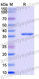 Recombinant Human ATXN2/Ataxin-2 Protein, N-GST & C-His