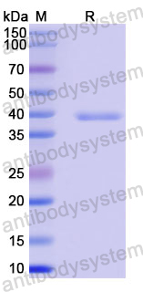 Recombinant Human SBF2/MTMR13 Protein, N-GST & C-His