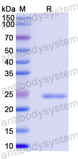 Recombinant Human FGD4/FRABP Protein, N-His