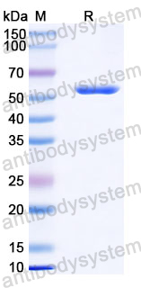Recombinant Human FIG4/SAC3 Protein, N-His