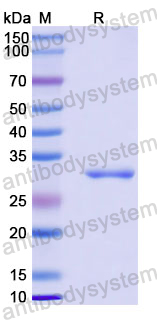 Recombinant Human FGGY Protein, N-His