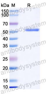 Recombinant Human ELP3 Protein, N-His