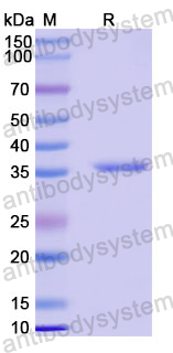 Recombinant Human UBQLN4/Ubiquilin-4 Protein, N-GST & C-His