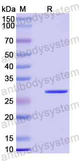 Recombinant Human ALS2/Alsin Protein, N-His