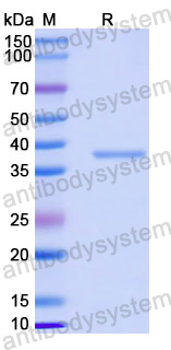 Recombinant Human NEK1 Protein, N-GST & C-His