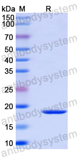 Recombinant Human VPS33A Protein, N-His