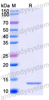Recombinant Human KIAA0586/TALPID3 Protein, N-His