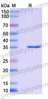 Recombinant Human CTPS2 Protein, N-His