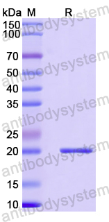 Recombinant Human CBLL1 Protein, N-His-SUMO
