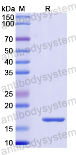 Recombinant Human CEP135 Protein, N-His