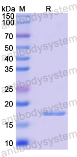 Recombinant Human DZIP1 Protein, N-His-SUMO