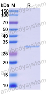 Recombinant Human ZNF671 Protein, N-His