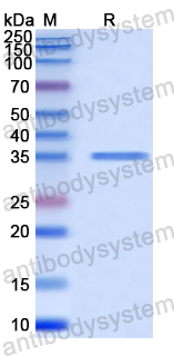 Recombinant Human PACSIN2 Protein, N-GST & C-His