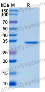 Recombinant Human TMEM165 Protein, N-GST & C-His