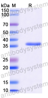 Recombinant Human ZHX2 Protein, N-GST & C-His